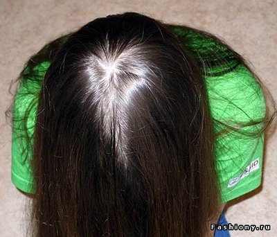 макушка головы.jpg